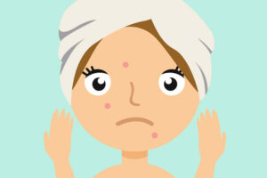acne on woman face