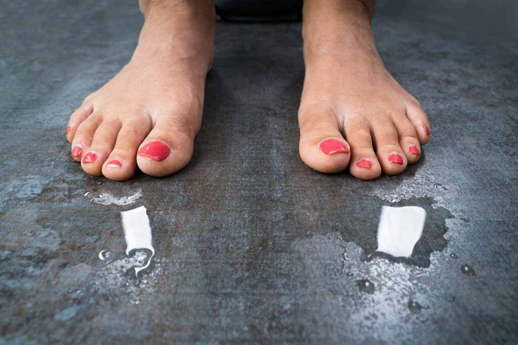 woman having sweaty feet