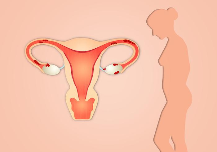 Bruised Cervix: From Symptoms to Treatment Options