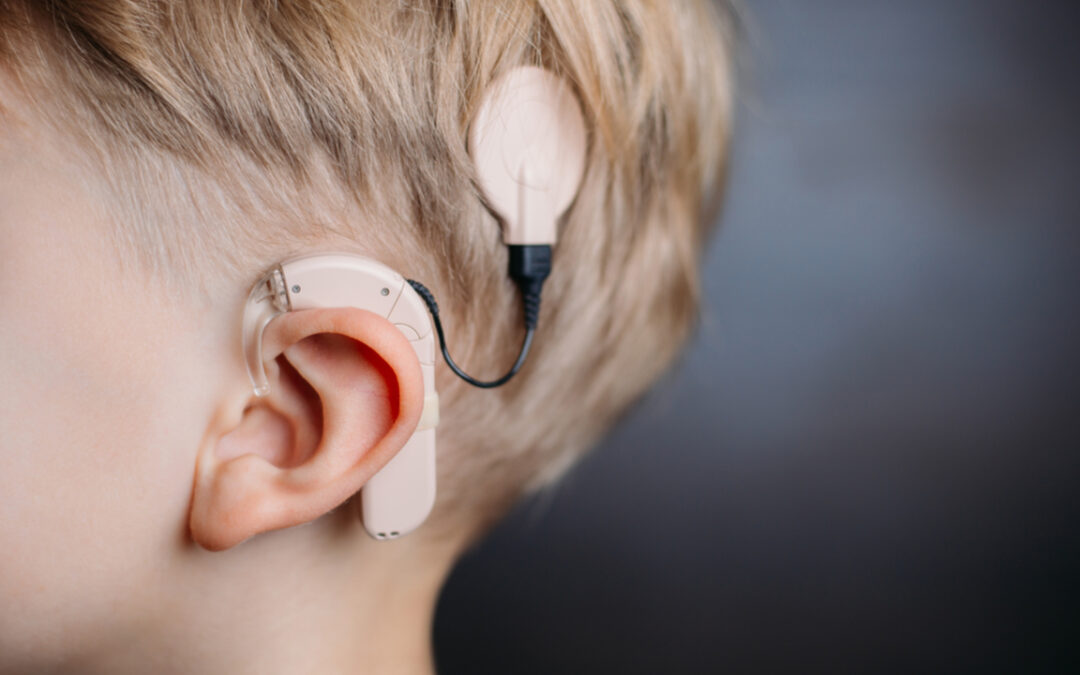 Everything You Want To Know About Cochlear Implants