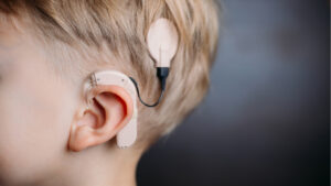 child with cochlear implant
