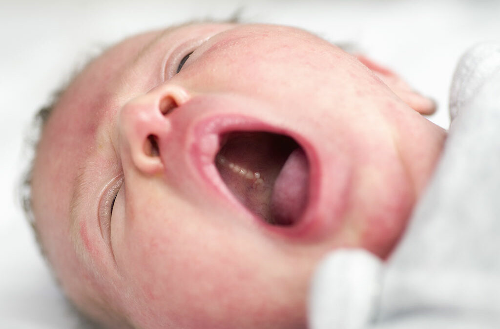 cysts in a baby's mouth