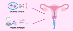 origin embryo in embryo transfer